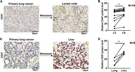 Human Lung Adenocarcinoma Cd47 Is Upregulated By Interferon γ And