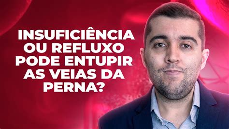 Quem Tem Entupimento Ou Refluxo Nas Veias Da Perna Pode Caminhar Ou