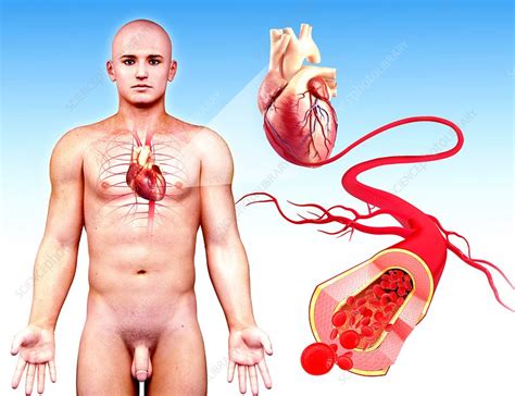 Male Cardiovascular System Artwork Stock Image F008 1670 Science