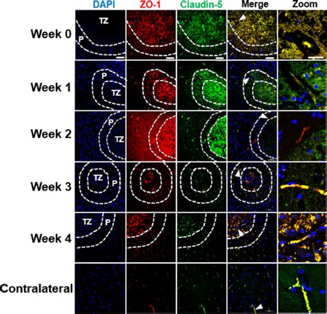 Characterization Of Bloodbrain Barrier Opening Induced By Transcranial