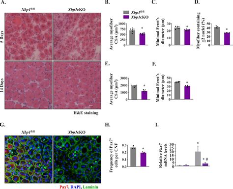 The Ire Xbp Signaling Axis Promotes Skeletal Muscle Regeneration