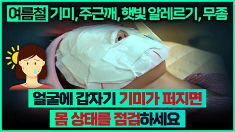 피부여름철 기미 주근깨 햇빛 알레르기 무좀피부가 흰 분들 자외선 차단 더 해야 합니다얼굴 피부빛이 검어지면 간