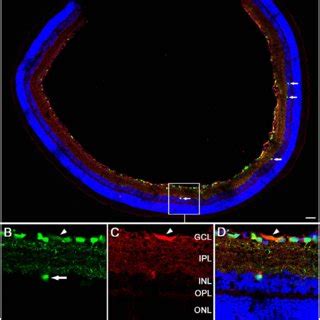 Fluorescent Confocal Micrographs Showing Characteristics Of Gfp