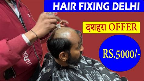 Hair Fixing Delhi Hair Wig Delhi Hair Patch Delhi Hair Solution Delhi Hair Baldness