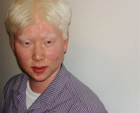 mindsize: albino asian will haunt your nightmares