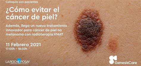 Genesiscare Un Tratamiento Innovador Para Cáncer De Piel No Melanoma