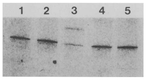 Denaturing Gradient Gel Electrophoresis Dgge Of Polymerase Chain Download Scientific Diagram