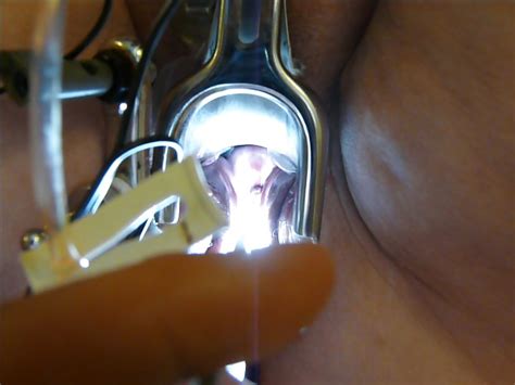 Amateur Female Electrostimulation Estim E Stim 11 Porn Pictures