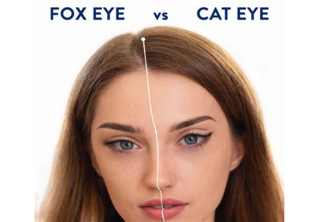 How To Choose Between Cat Eye And Fox Eye Thread Lift Costs Yastrid