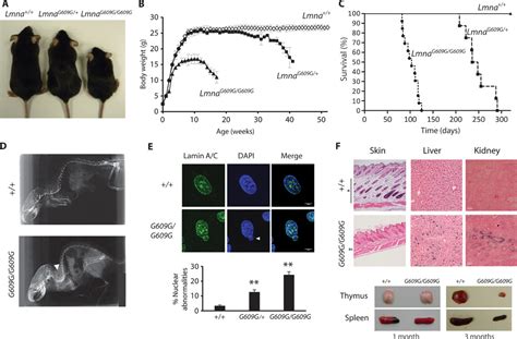 Splicing Directed Therapy In A New Mouse Model Of Human Accelerated