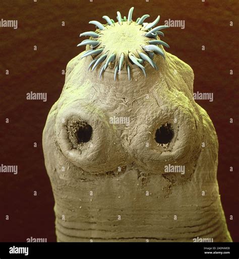 Tapeworm Light Micrograph Of The Scolex Head Like Structure Of A Parasitic Tapeworm Taenia