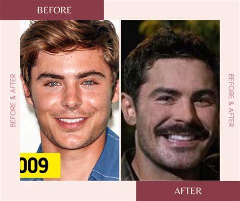 Zac Efrons Incredible Transformation All You Need To Know About His