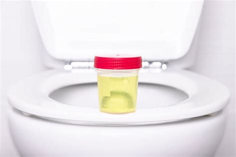 Urinalysis In Singapore Aare Urocare Dr Fiona Wu Urologist