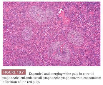 Spleen Basicmedical Key