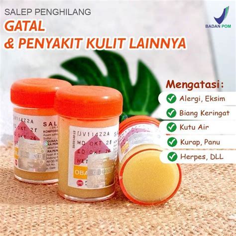 Jual Salep Zwafel Obat Salep Gatal Paling Ampuh Mengatasi Gatel