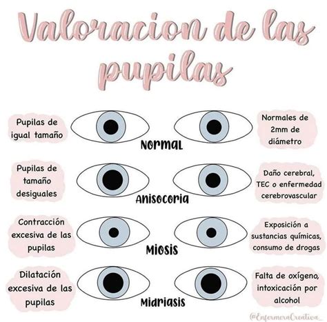 Valoración de las pupilas Tecnico auxiliar de enfermeria Material de