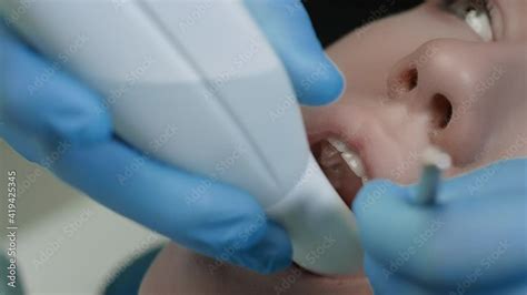 Doctor Scans The Patient S Teeth In The Clinic The Dentist Holds In