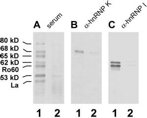 Detection Of Hnrnp K And Hnrnp I In Reconstituted Hy Rnp Complexes