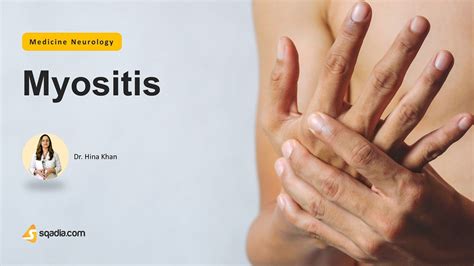 Myositis