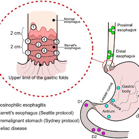 Photo Documentation D1 Duodenal Bulb D2 Second Part Of Duodenum Download Scientific Diagram