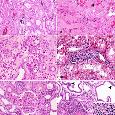 Chronic Progressive Nephropathy CPN Naked Mole Rat Kidney Figure