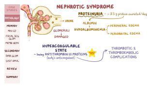 Hyaline Casts: What Are They, Causes, Diagnosis, Treatment, and More ...