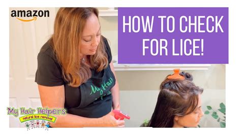 How To Check For Head Lice Wet Check Once A Week Take A Peek Youtube