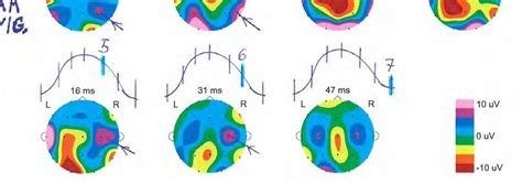 Upper Part Gabor Analysis Ga Of Alfa Activity In Eeg While Waking