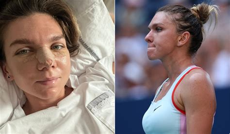 Simona Halep nu va mai juca în 2022 după ce s a operat S a încheiat