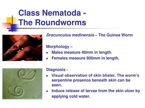 Ppt Class Nematoda The Roundworms Powerpoint Presentation Free