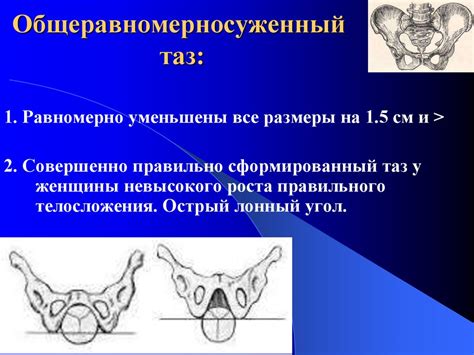 Узкий таз в современном акушерстве. (Лекция 18) - презентация онлайн
