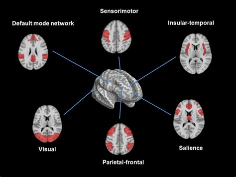 Frontiers Structural And Functional Brain Patterns Of Non Motor