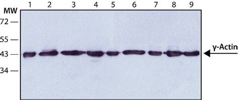 Anti Actin Antibody Mouse Monoclonal