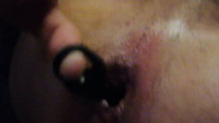 Huge Anal Plug Tore Anal Sphincter