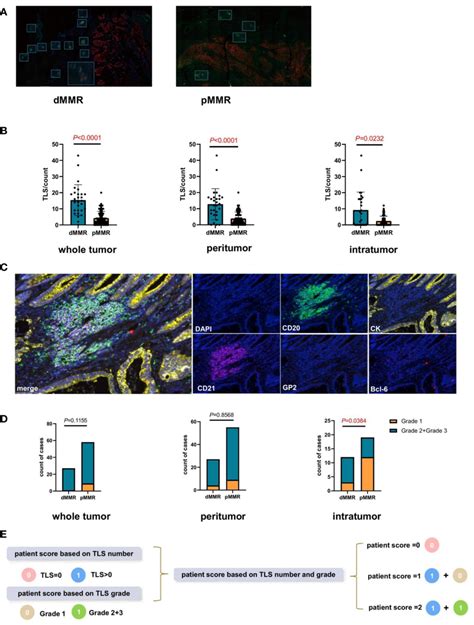 Comparison Of The Tertiary Lymphatic Structure TLS Quantity And