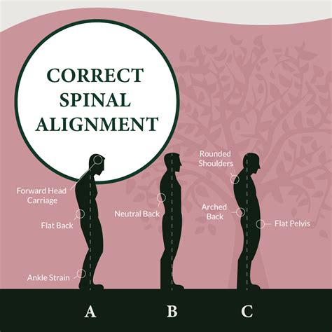 Correct Spinal Alignment Provolution Health