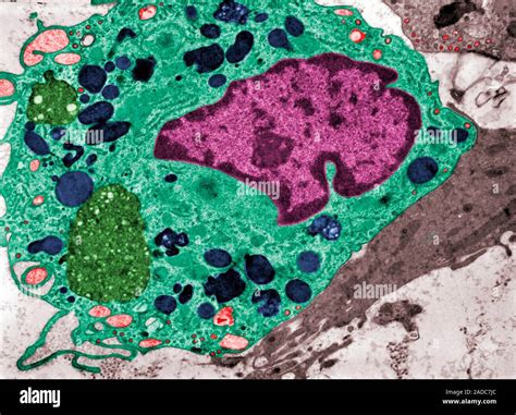 False Colour Transmission Electron Micrograph Tem Showing A