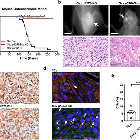 Hedgehog Signaling And Primary Cilia Formation In Human Osteosarcoma In