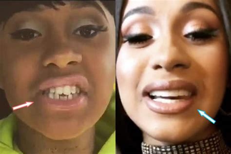 Cardi B Plastic Surgery REVEALED! (Before & After Photos 2021)