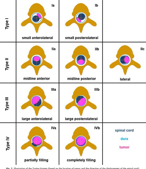 Figure 2 From Proposal Of A New Radiological Classification System For