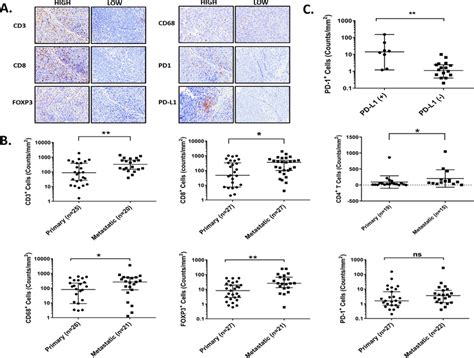 Immune Infiltrates And Pd L1 Expression In Primary And Metastatic Uveal