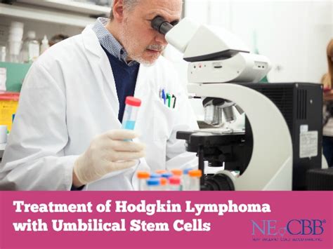 Stem Cell Treatment of Hodgkin Lymphoma