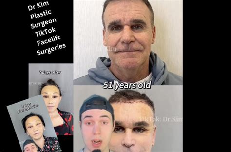 Who Is Dr Kim Plastic Surgeon TikTok Alleged Scary Facelift Surgeries