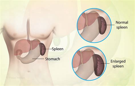 Health Condition : Symptoms, Causes, Treatment and More