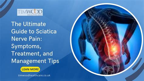 The Ultimate Guide to Sciatica Nerve Pain: Symptoms, Treatment, and ...