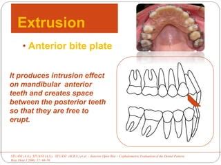 Mandibular curve of spee | PPT