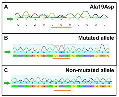 Sequencing Electropherogram Of Exon Of The Ttr Gene Shows A