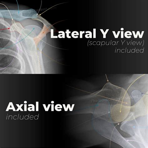 Shoulder X Rays Of Normal Shoulder 6