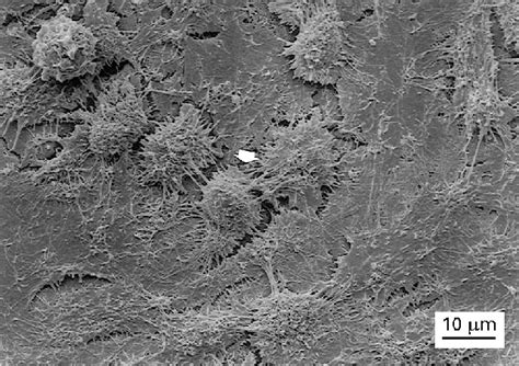 Scanning Photomicrograph Of A Rbmc Cell Layer Surface On Ti Al Fe