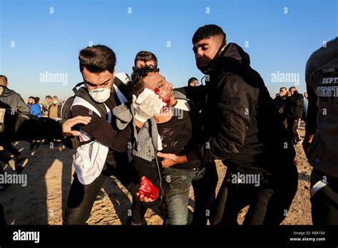 La Striscia Di Gaza La Palestina Il 14 Dicembre 2018 Un Uomo Ferito